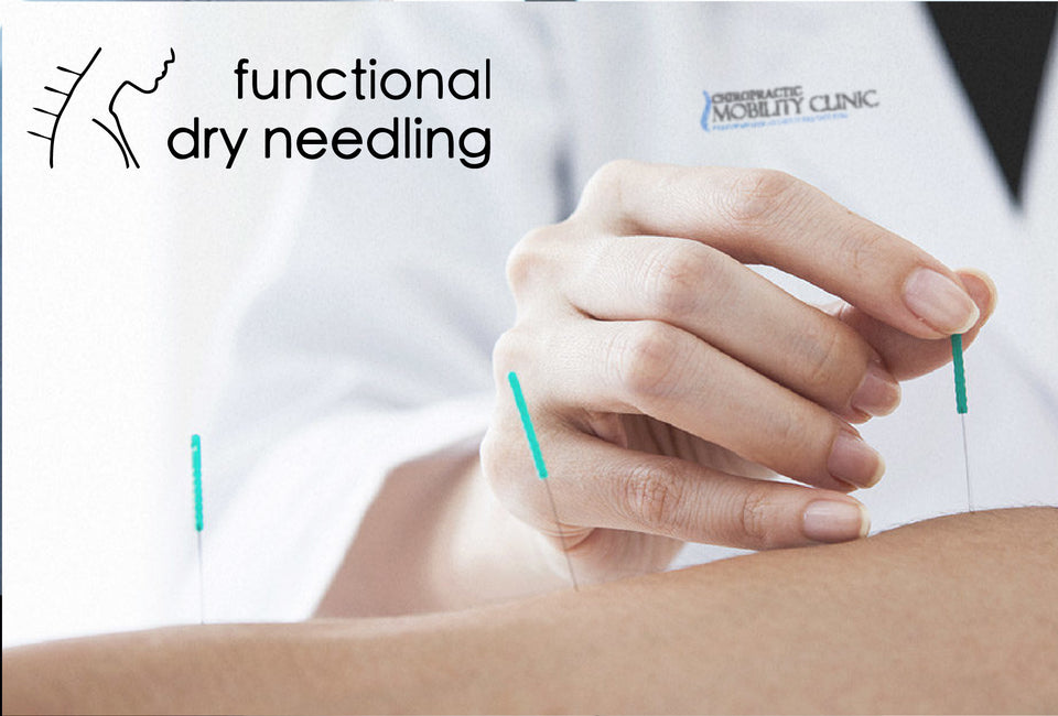 files/dry_needling-01-01.jpg
